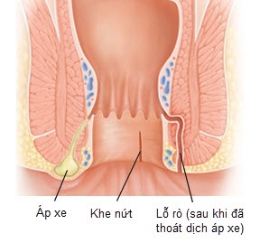 Khi bị ngứa chỗ không muốn... gãi - 1 Khi bị ngứa chỗ không muốn... gãi - 1