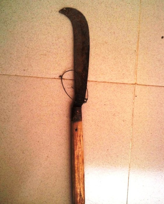 Cứu sống bệnh nhân dùng rựa tự chặt cổ mình - 1 (Ảnh mang tính minh họa)