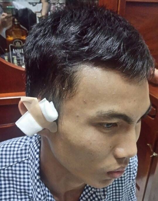 Đình chỉ công tác phường đội trưởng nổ súng bắn người - 1 Anh Đỗ Quyết Thắng tố cáo bị ông Minh bắn bị thương ở tai.