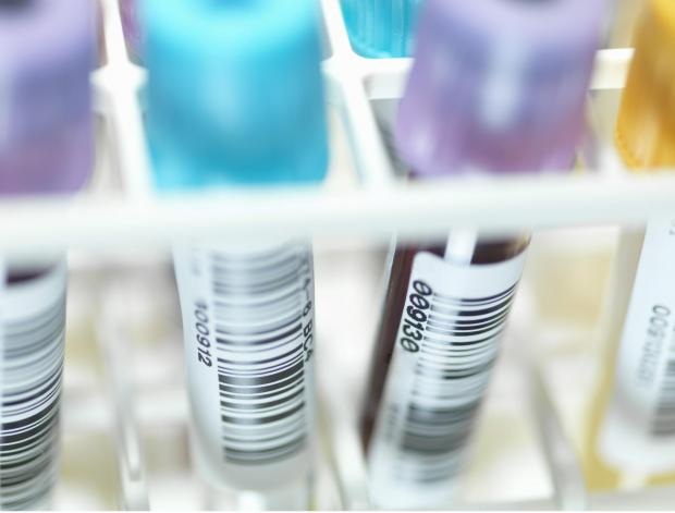 Bắt đầu thử nghiệm trên người loại vắc-xin có thể đẩy lùi HIV - 1 Các nhà nghiên cứu hy vọng sẽ chứng minh được loại thuốc này sẽ có hiệu quả ít nhất là 50%