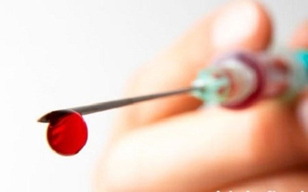 15 chiến sĩ công an, cán bộ y tế bị phơi nhiễm HIV trong lúc làm nhiệm vụ - 1 15 chiến sĩ công an, cán bộ y tế bị phơi nhiễm HIV trong lúc làm nhiệm vụ - 1