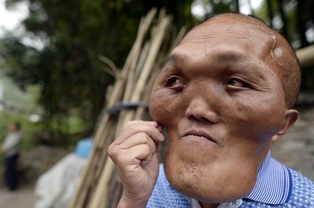 
Ông Xia Yuanhai được dân làng biết đến với khuôn mặt giống người ngoài hành tinh.
