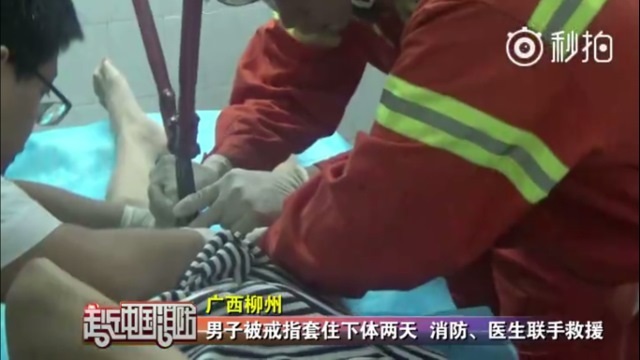 Thanh niên khốn khổ vì tự dưng đeo nhẫn vào “của quý” - 2 Thanh niên khốn khổ vì tự dưng đeo nhẫn vào “của quý” - 2