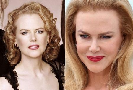 Sao Hollywood và những “quả đắng” mang tên phẫu thuật thẩm mĩ - 1 Khi Nicole Kidman tham gia giới thiệu bộ phim “Grace of Monaco” tại Liên hoan phim Cannes, tất cả mọi sự chú ý ngay lập tức đổ dồn vào gương mặt cứng đờ của “thiên nga nước Úc”. Có vẻ như nữ diễn viên này đã lạm dụng việc làm căng da mặt, khiến cho các biểu cảm trở nên vô cùng gượng ép.