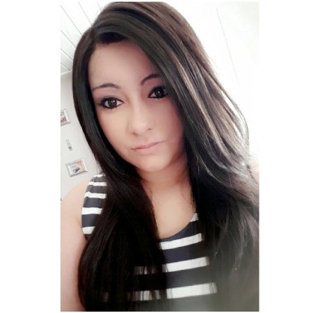 Cô gái trẻ luôn phải sử dụng tóc giả khi đi ra ngoài