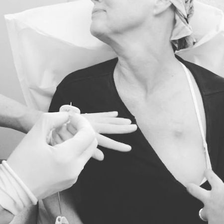 Sao phim “Phép thuật” chia sẻ đoạn phim điều trị ung thư giàu nghị lực - 2 … khiến cho nhiều người hâm mộ cảm thấy nghẹn ngào