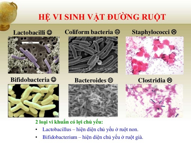 Ăn bánh mì cũng bị say sỉn, vì sao? - 3 Ăn bánh mì cũng bị say sỉn, vì sao? - 3