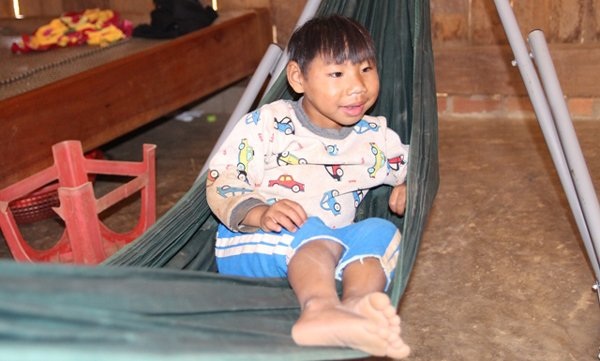Thêm 2 trẻ dị tật đầu nhỏ - 2 Thêm 2 trẻ dị tật đầu nhỏ - 2