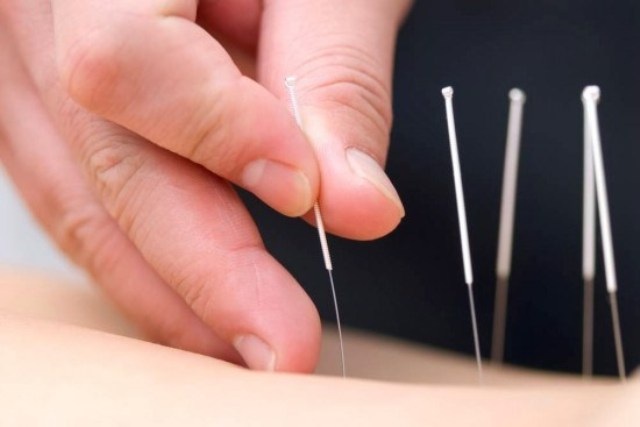 Trúng gió méo miệng nhưng nguy hiểm cho mắt - 3 Trúng gió méo miệng nhưng nguy hiểm cho mắt - 3