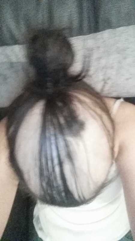 Tự ti vì rụng tóc, Ashleigh từng không dám nhìn vào gương và chỉ ở lì trong phòng