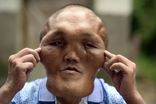 Ông Xia Yuanhai mong muốn một ngày có thể trở lại với khuôn mặt bình thường.