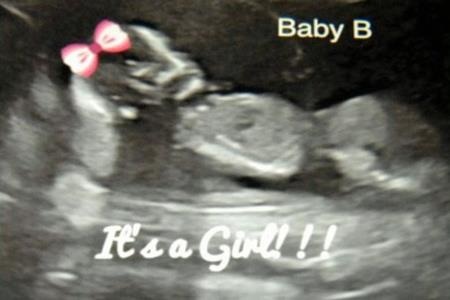 Nhiều người gửi ảnh siêu âm con cho Matt sau khi nhận tinh trùng