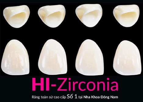 Cùng tìm hiểu về loại răng sứ mới nhất - 2
(Răng toàn sứ cao cấp Hi-Zirconia)