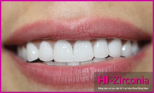 Cùng tìm hiểu về loại răng sứ mới nhất - 3
(Răng Hi-Zirconia là dòng răng sứ độc quyền tại Nha Khoa Đông nam)