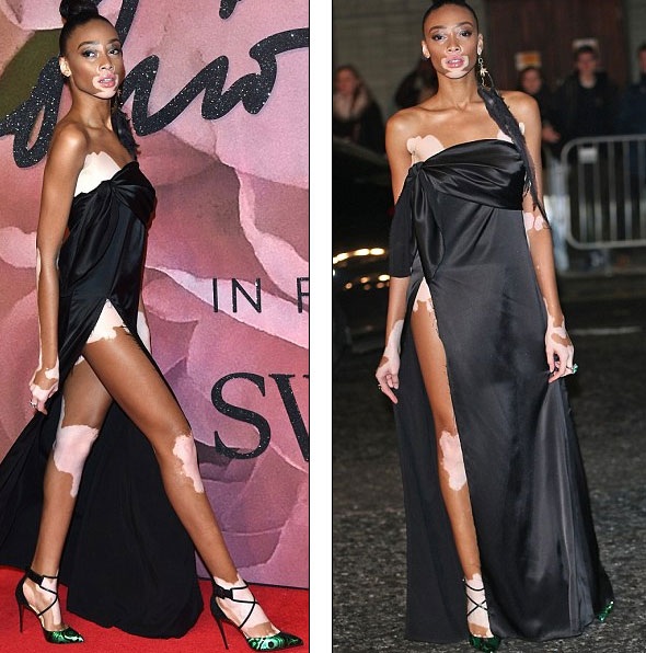 Váy xẻ táo bạo của người mẫu bạch tạng Winnie Harlow - 1
Người mẫu Winnie Harlow sải bước tại lễ trao giải thời trang Anh quốc năm 2016, ngày 5/12.
