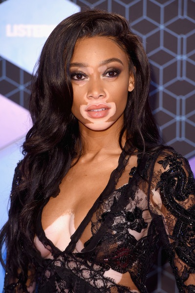 Người mẫu bạch tạng Winnie Harlow ngày càng nổi tiếng - 11
Giờ đây, Winnie được mời tham dự nhiều sự kiện giải trí đình đám trên thế giới và là một trong những chân dài nổi tiếng nhất thế giới hiện nay.
