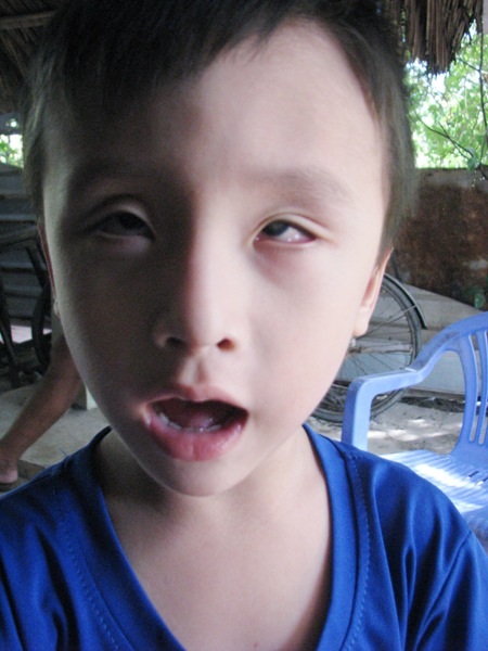 “Mẹ ơi, con muốn sáng mắt !” - 12 Để mang lại ánh sáng cho cháu bé đáng thương này, rất mong các nhà hảo tâm hãy cùng sẻ chia.