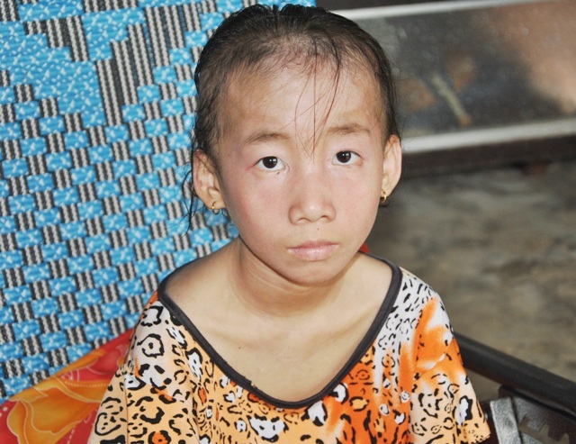 Thương bé gái bị lở loét khắp người phải nghỉ học vì không tiền chữa bệnh - 1 Nhiều năm qua, căn bệnh viêm da cơ đã hành hạ cháu Phạm Ngọc Tiên từ một cô bé xinh xắn trở nên tiều tụy.