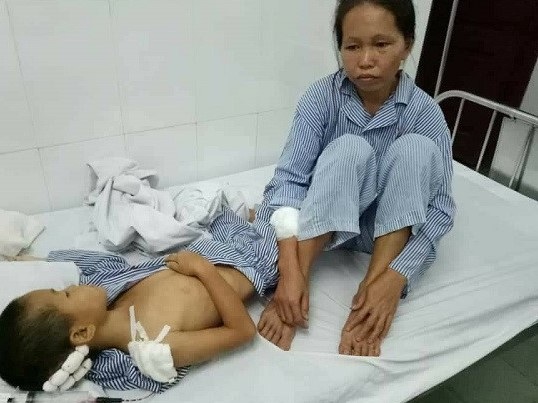 Say rượu, chồng vung dao chém vợ con không thương tiếc - 1
Sau nhiều nhát dao của chồng, của cha, 2 mẹ con phải nhập viện cấp cứu (ảnh CTV)