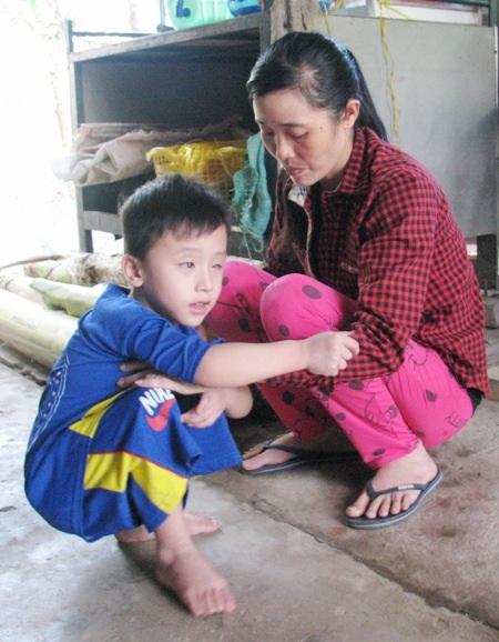 “Mẹ ơi, con muốn sáng mắt !” - 6 Không thể chạy nhảy, sân chơi của cháu bé này chỉ quẩn quanh trong hiên nhà và lúc nào cũng phài có mẹ ở bên cạnh.