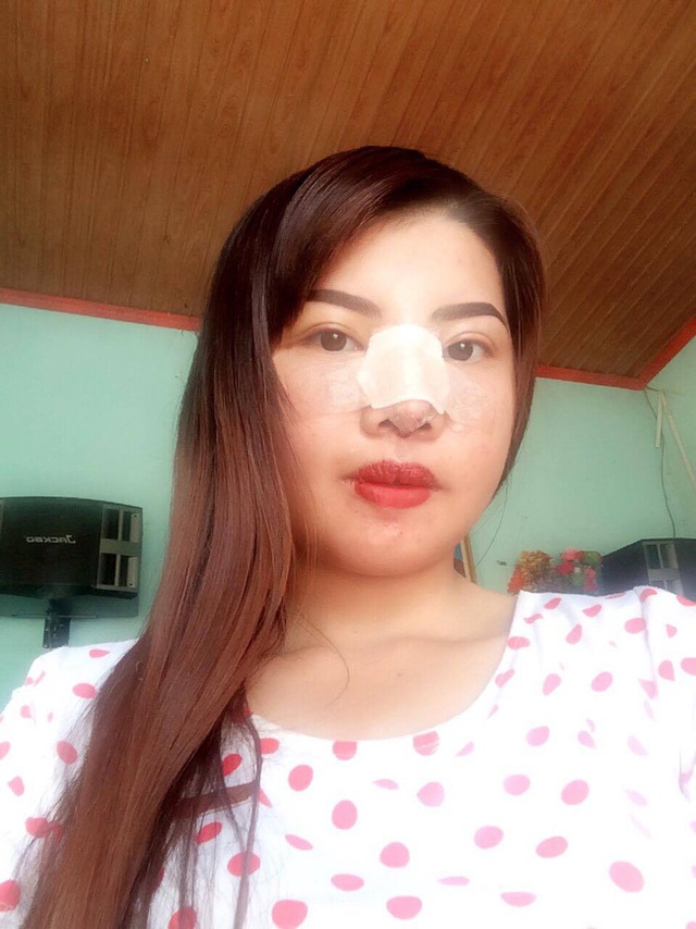 Hành trình hóa “thiên nga” của bà mẹ một con từng bị chê "xấu như thị Nở" - 2 Hình ảnh của cô gái trẻ sau khi thực hiện những ca phẫu thuật đầu tiên. (Ảnh: NVCC)