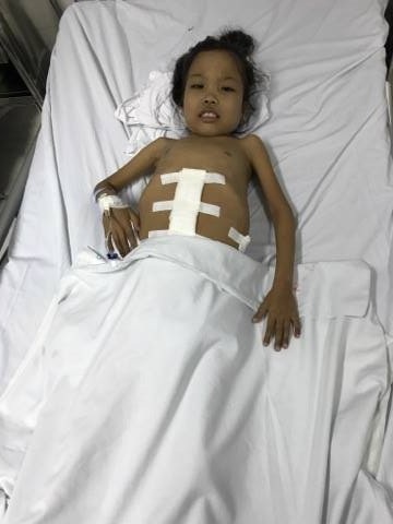 Được bạn đọc Dân trí giúp đỡ kịp thời, cô bé Lò Thị Nhớn đã được phẫu thuật cắt lách kịp thời.