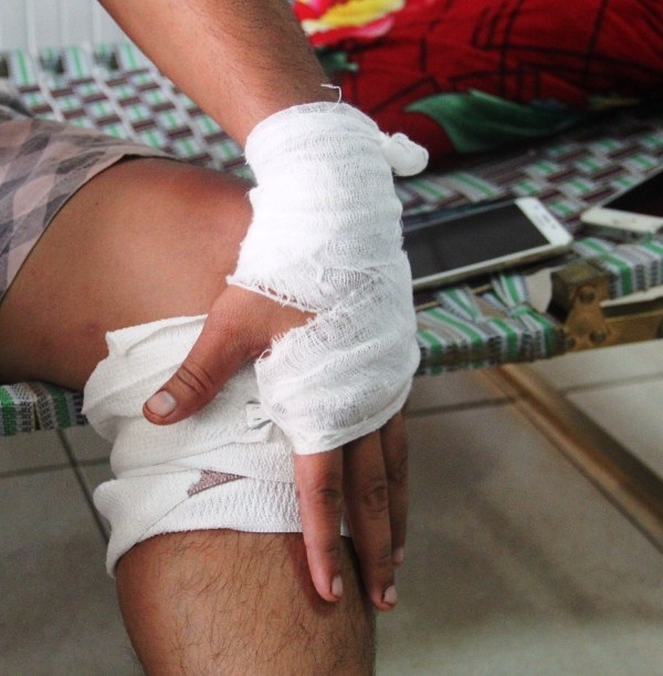 Phá giá chở khách, chủ xe bị đánh trọng thương? - 3 Vết thương nặng ở chân khiến ông Vương đi lại rất khó khăn