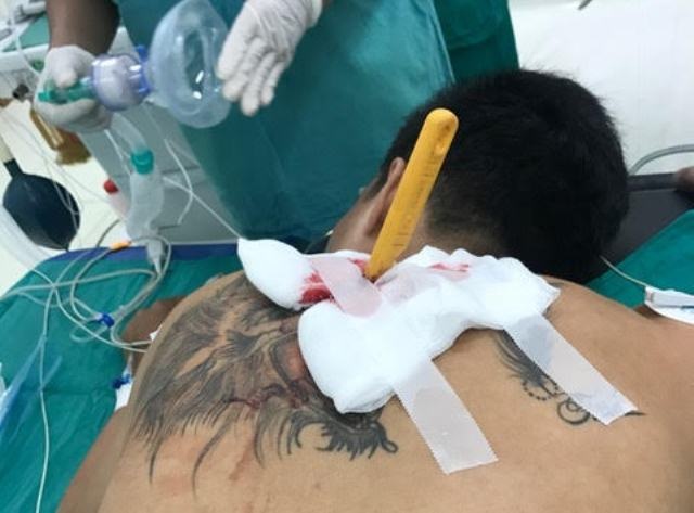 Cứu thanh niên bị nhập viện với dao dính chặt ở lưng - 2 Bệnh nhân được đưa vào phòng phẫu thuật