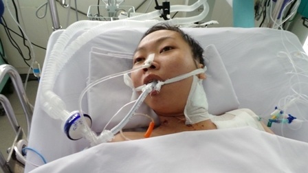 Cô giáo trẻ nguy kịch vì một vết ong chích - 3
Hơn 1 tuần điều trị, Thúy Quyên dần qua được nguy kịch nhưng thời gian nằm viện còn kéo dài