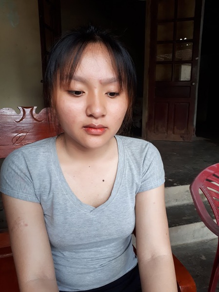 Lan Anh, con gái thứ 2 của bà Khuyên hiện cũng đang bị chứng bệnh giống mẹ. Năm trước Lan Anh cũng đã phải phẫu thuật vú để ngăn chứng ung thư lây lan.