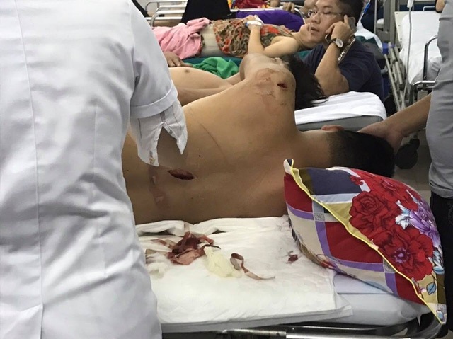 Vụ nam thanh niên bị côn đồ bịt mặt truy sát: Xét xử tại quê các bị cáo - 2
Nạn nhân Liêm lĩnh hàng loạt vết chém trên khắp cơ thể.