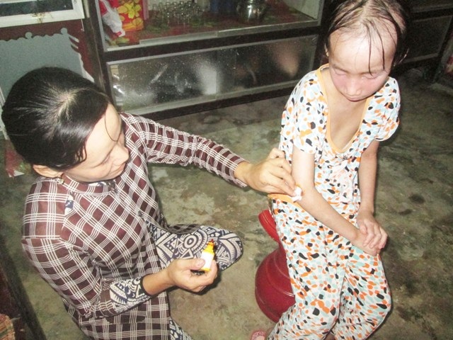 Thương bé gái bị lở loét khắp người phải nghỉ học vì không tiền chữa bệnh - 6 Thương bé gái bị lở loét khắp người phải nghỉ học vì không tiền chữa bệnh - 6