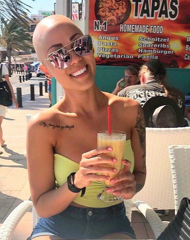 Đã từng có thời, Therese rất tự ti, mặc cảm về mái tóc của mình, cô tìm mọi cách để che giấu tình trạng mà mình đang gặp phải.