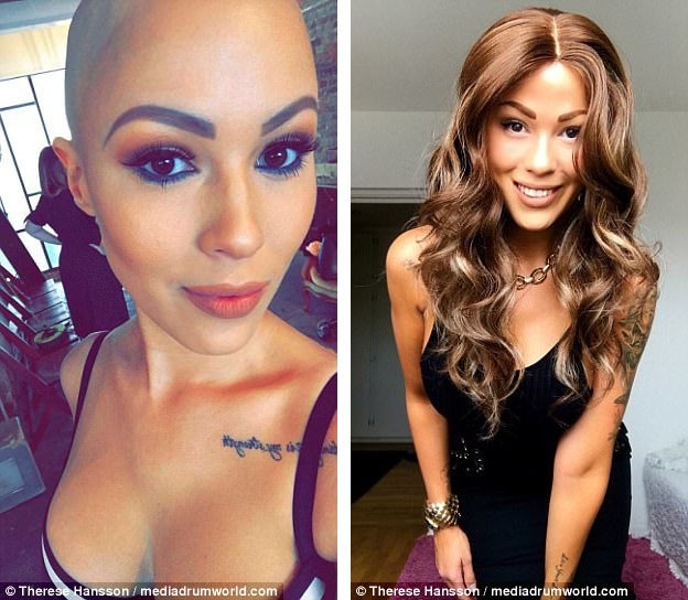 Giờ đây, Therese bước ra phố mà không cần đội tóc giả thêm nữa.