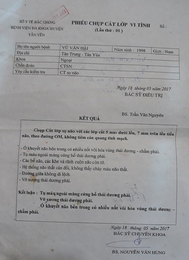 Mới đây Hải đang đi ngoài đường thì bất ngờ lên cơn, khiến ngã đến tụ máu não.