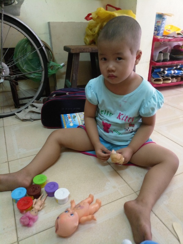 Cha bất lực nhìn con quằn quại trong cơn đau - 1 Đã 4 tuổi nhưng Như Ngọc nhỏ như đứa bé lên 2