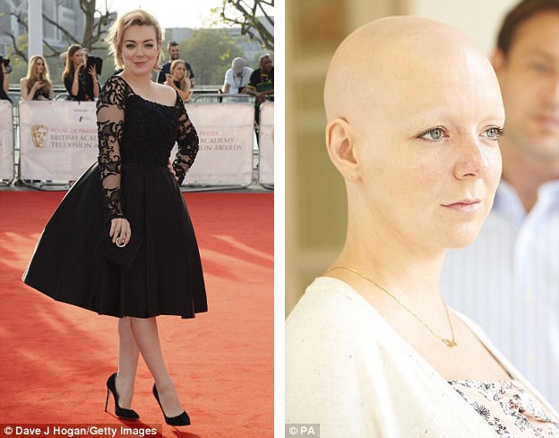 Nữ diễn viên người Anh Sheridan Smith (36 tuổi) vào vai bệnh nhân ung thư trong bộ phim “The C-Word” (2015).