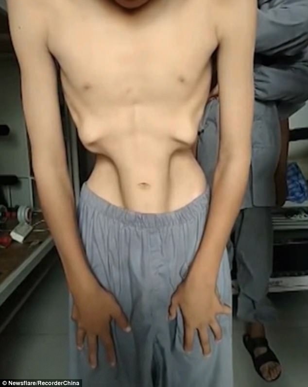 Kinh ngạc xem võ sinh Thiếu Lâm Tự “biến hình” - 1 Võ sinh thứ nhất có thể khiến cho cơ bụng chuyển động như những làn sóng, sau đó hóp bụng lại như thế này.