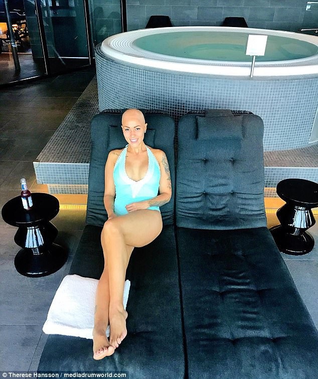 Therese khẳng định rằng cô cảm thấy “nhẹ người đi rất nhiều” sau khi chia sẻ cởi mở về chứng rụng tóc của mình.