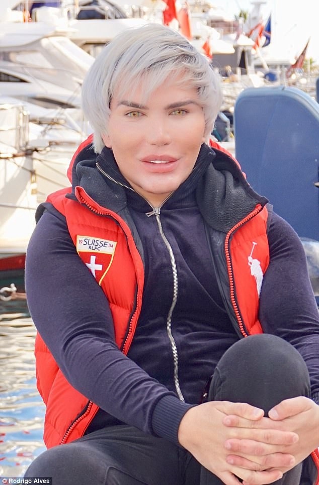 
Rodrigo Alves nói, ca phẫu thuật khá nguy hiểm nên anh sẽ phải chuẩn bị thể chất tốt nhất để ca phẫu thuật thành công. Tôi phải tập gym hàng ngày. Tôi có 3 HLV riêng giúp tôi có vóc dáng săn chắc hơn. Ngoài ra tôi không được uống rượu bia, điều này quả là khó vì cuối năm tôi nhận được rất nhiều lời mời đi dự tiệc mà phải từ chối.
