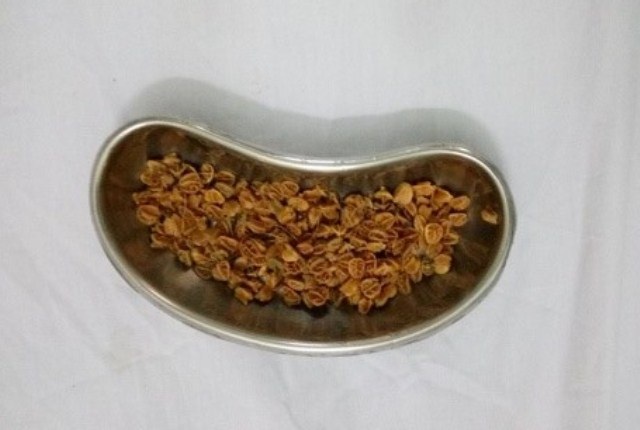 Hạt sơ-ri được lấy ra từ ống hậu môn của bệnh nhi P., trong đó có nhiều hạt đã lên mầm