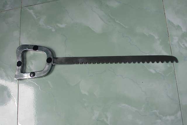 Biểu diễn nuốt kiếm và lưỡi cưa, 2 người đàn ông suýt mất mạng - 1 Lưỡi cưa mà ông P. nuốt làm thủng thực quản.