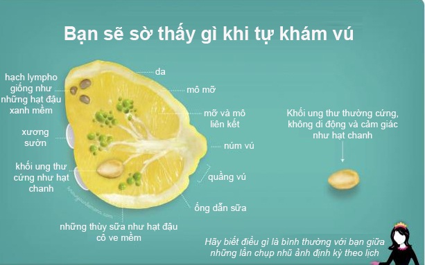 Tìm hiểu về ung thư vú qua… trái chanh - 2
Ảnh: Ngọc Diệp