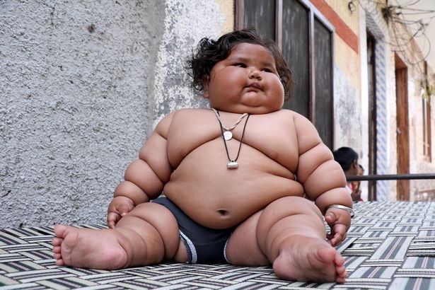 
Little girl Chahat weighed 19kg when she was just 8 months old
