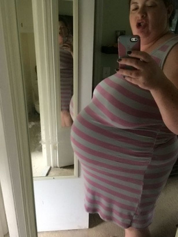 Em bé sơ sinh khổng lồ nặng hơn 6.5 kg - 3
Mẹ Colin khi mang thai