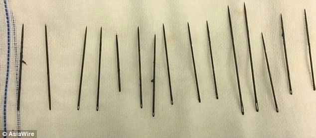 Kinh dị người đàn ông nhét 15 cây kim vào của quý - 2 
Những cây kim được lấy ra đều dài từ 5 đến 10cm.