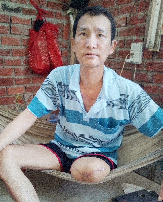 Chưa đủ cơ sở kết luận bệnh viện chuyển viện chậm dẫn đến bệnh nhân bị cưa chân - 2 Anh Lý Thanh Trường phải cưa chân sau vết thương ở bàn chân và bị bệnh đái tháo đường nhiều năm.