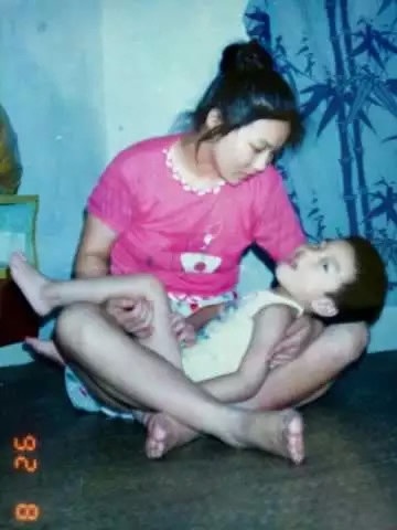 Chuyện cảm động về người mẹ nuôi con bại não hoàn thành "giấc mơ Harvard" - 3 Bà kiên trì cùng con vượt qua khó khăn của bệnh tật