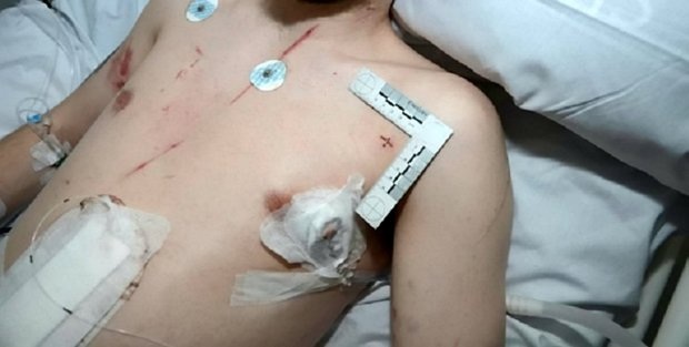 Người đàn ông bị vị hôn thê bạo hành suýt chết - 2 Người đàn ông bị vị hôn thê bạo hành suýt chết - 2