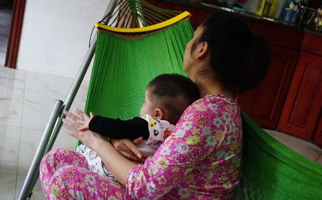 Vụ bé 5 tháng tuổi bị đánh, giật lắc: Bảo mẫu gửi lời xin lỗi - 4
Bé Đinh A.N bị phồng thóp, nghi phồng não. Sau khi cho người trông trẻ nghỉ việc, mẹ bé quyết định nghỉ việc để trông con